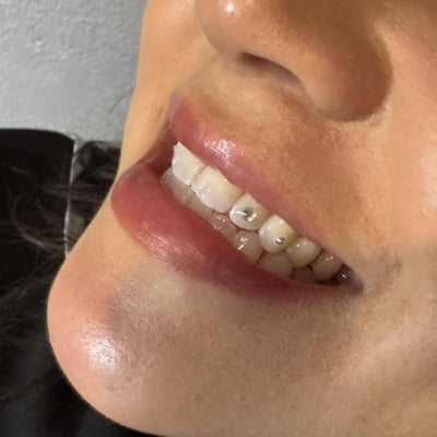TOOTH GEMS